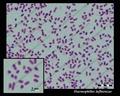 haemophilus influenzae